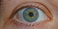 Augenakupunktur